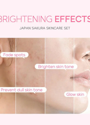 Sakura-Kit de 3 piezas para mujer, crema facial, esencia para ojos, suero para el cuidado de la piel, caja de regalo