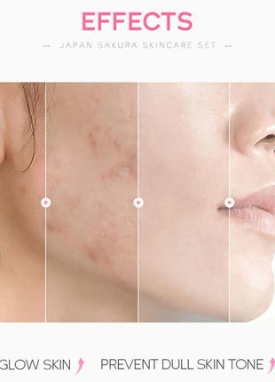 5/3 unids/set Sakura juegos para el cuidado de la piel crema Facial suero tóner limpiador Facial protector solar crema para ojos caja de regalo producto para el cuidado de la piel Facial